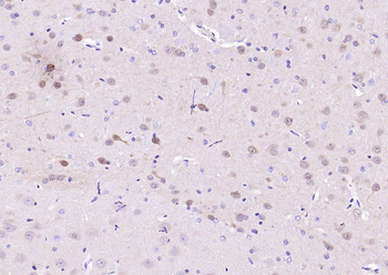 ERK2 Recombinant Rabbit Monoclonal Antibody