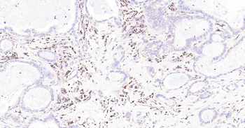 Cyclophilin B Mouse Monoclonal Antibody (Loading Control)