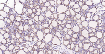 Cyclophilin B Mouse Monoclonal Antibody (Loading Control)