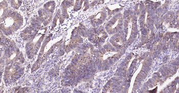 Cyclophilin B Mouse Monoclonal Antibody (Loading Control)