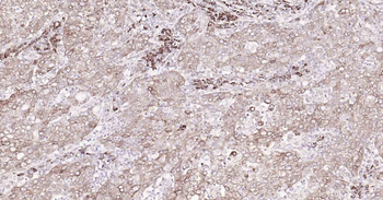 Cyclophilin B Mouse Monoclonal Antibody (Loading Control)