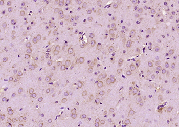 Cyclooxygenase 1 Rabbit Polyclonal Antibody