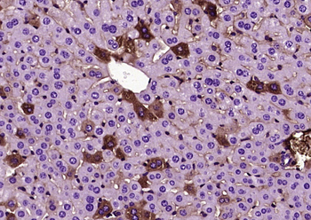 Ox-LDL Mouse Monoclonal Antibody