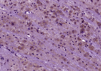 Bid Rabbit Polyclonal Antibody