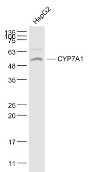 CYP7A1 Rabbit Polyclonal Antibody