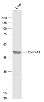 CYP7A1 Rabbit Polyclonal Antibody