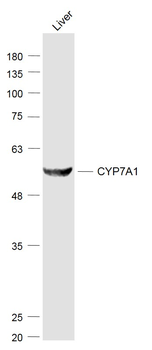 CYP7A1 Rabbit Polyclonal Antibody