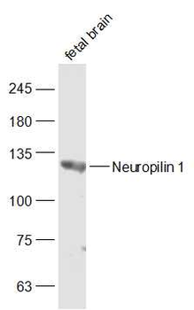 Neuropilin 1 Rabbit Polyclonal Antibody