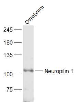 Neuropilin 1 Rabbit Polyclonal Antibody