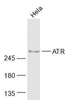 ATR Rabbit Polyclonal Antibody