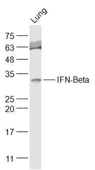 IFNB1 Rabbit Polyclonal Antibody