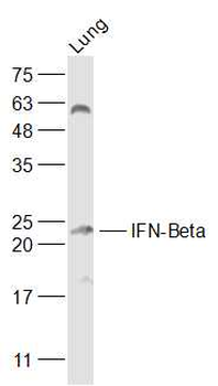 IFNB1 Rabbit Polyclonal Antibody