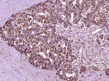 MERTK Rabbit Polyclonal Antibody