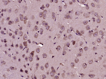 Mitofusin 2 Rabbit Polyclonal Antibody