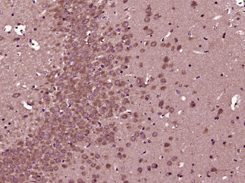 TFPI-2 Rabbit Polyclonal Antibody