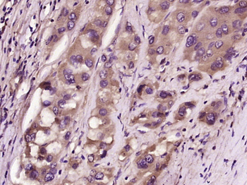 FGF21 Rabbit Polyclonal Antibody