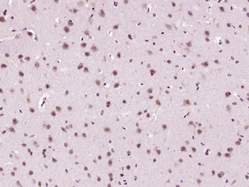 Ctip2 Rabbit Polyclonal Antibody