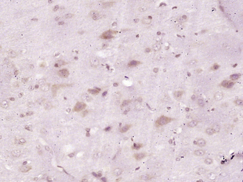 FGF1 Rabbit Polyclonal Antibody