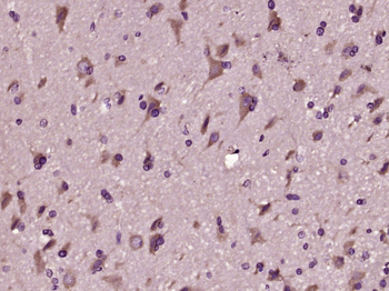 Aβ1-42 (CT) Rabbit Polyclonal Antibody