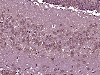 PKN Rabbit Polyclonal Antibody