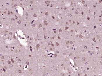 MAP2 Rabbit Polyclonal Antibody