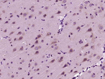 MAP2 Rabbit Polyclonal Antibody