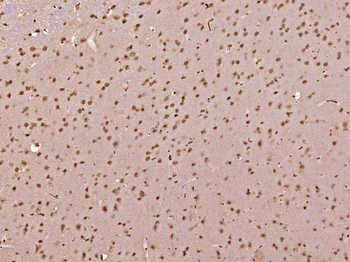 FGF1 Rabbit Polyclonal Antibody