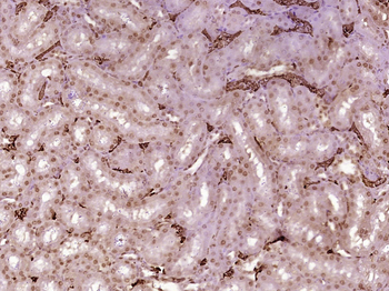 FGF1 Rabbit Polyclonal Antibody