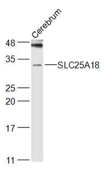 SLC25A18 Rabbit Polyclonal Antibody