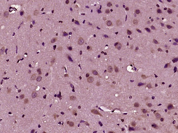 SH3GLB2 Rabbit Polyclonal Antibody