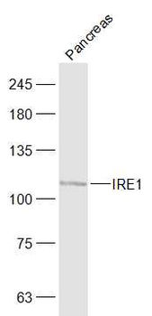IRE1 Rabbit Polyclonal Antibody