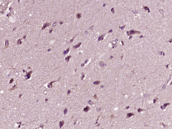 Parkin Rabbit Polyclonal Antibody