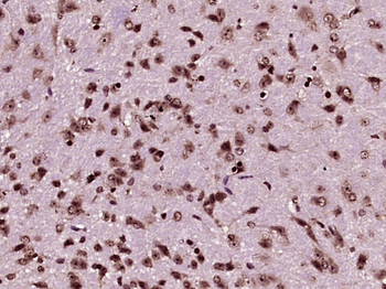 Parkin Rabbit Polyclonal Antibody