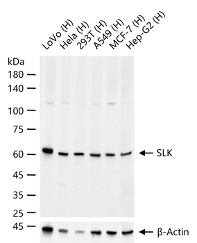 SLK Rabbit Polyclonal Antibody
