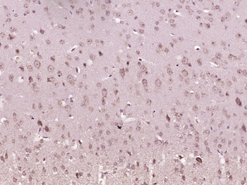 SLK Rabbit Polyclonal Antibody