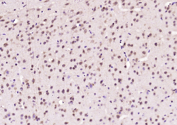 Phospho-SLK (Tyr530) Rabbit Polyclonal Antibody
