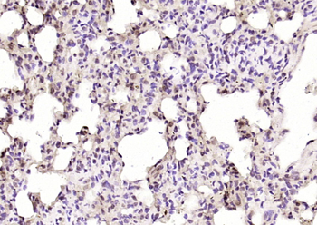 Phospho-SLK (Tyr530) Rabbit Polyclonal Antibody