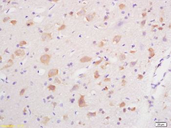 GABA A Receptor gamma 2 Rabbit Polyclonal Antibody