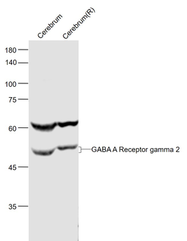 GABA A Receptor gamma 2 Rabbit Polyclonal Antibody