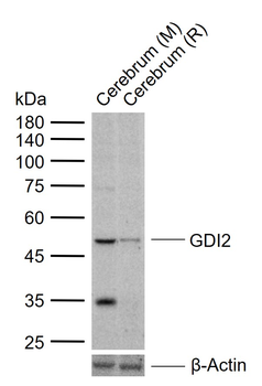 GDI2 Rabbit Polyclonal Antibody