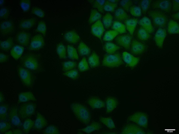 ID1 Rabbit Polyclonal Antibody
