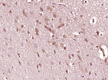 GLO1 Rabbit Polyclonal Antibody