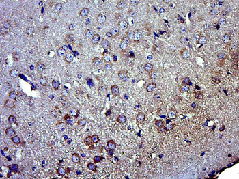 GPD2 Rabbit Polyclonal Antibody
