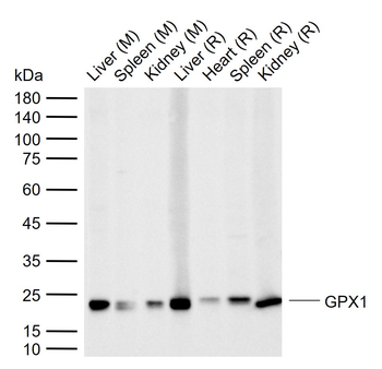 GPX1 Rabbit Polyclonal Antibody