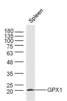 GPX1 Rabbit Polyclonal Antibody