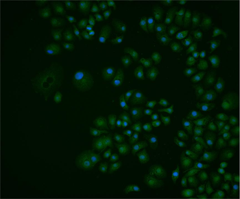GRIM19 Rabbit Polyclonal Antibody