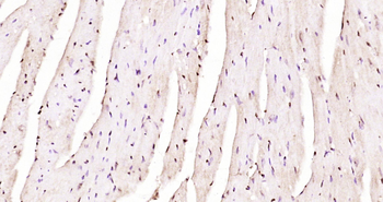 GRIM19 Rabbit Polyclonal Antibody