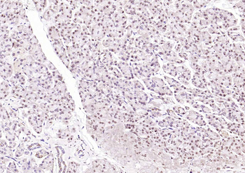 Phospho-GSK-3 Beta (Ser21+Ser29) Rabbit Polyclonal Antibody