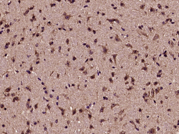 Phospho-GSK-3 Beta (Ser21+Ser29) Rabbit Polyclonal Antibody