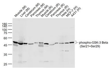 Phospho-GSK-3 Beta (Ser21+Ser29) Rabbit Polyclonal Antibody